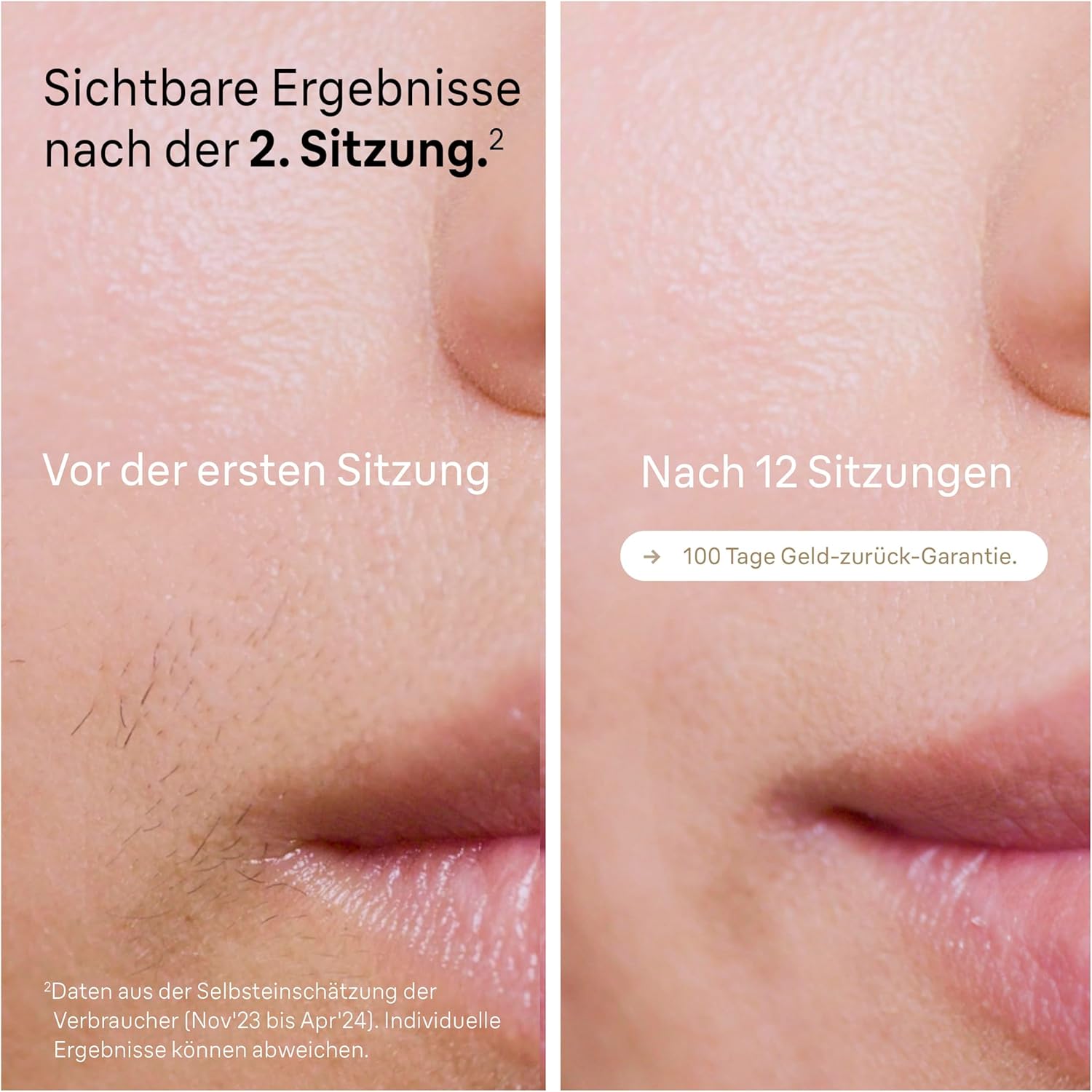 Braun IPL Silk Expert Pro 5 PL5358 – Épilateur à lumière pulsée, épilation définitive et indolore à domicile – Étui inclus, rasoir Venus, 4 accessoires, conçu en Allemagne – Blanc/Or