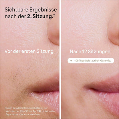 Braun IPL Silk Expert Pro 5 PL5358 – Épilateur à lumière pulsée, épilation définitive et indolore à domicile – Étui inclus, rasoir Venus, 4 accessoires, conçu en Allemagne – Blanc/Or